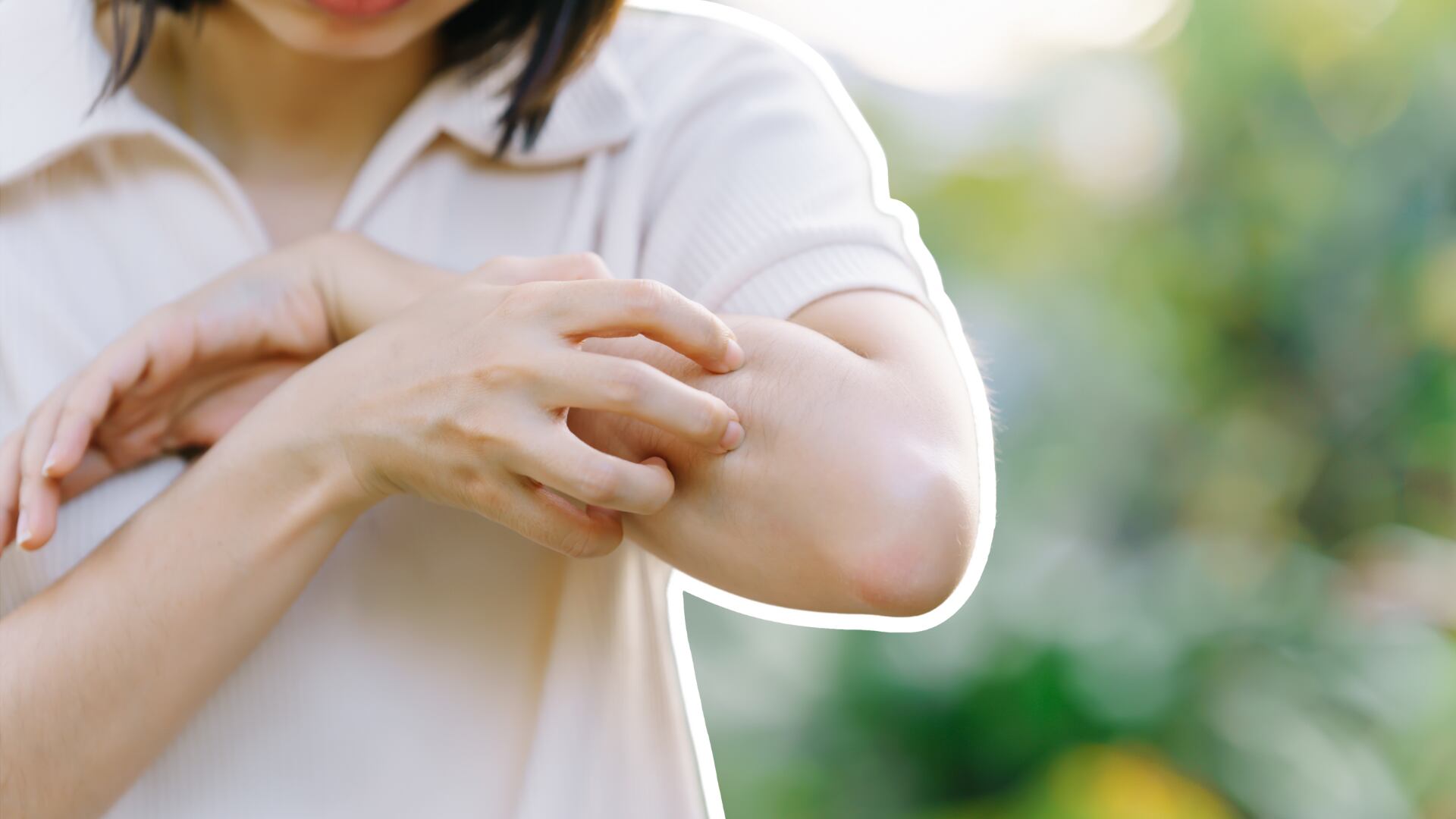 Con el tratamiento adecuado se pueden lograr largos periodos sin lesiones activas.