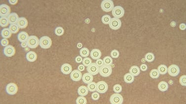 Tuberculosis vuelve más letal a hongo que causa meningitis, alerta estudio