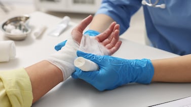 Quemaduras en niños aumentan a fin de año, sepa cómo evitarlas y actuar