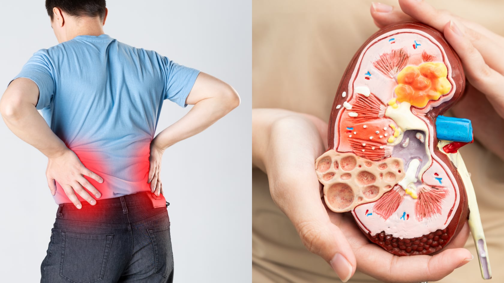 Fatiga, cambios en la orina o hinchazón pueden alertar sobre enfermedad renal. Expertos explican síntomas tempranos y medidas de prevención.