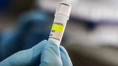 La transmisión de hantavirus en el crucero es ‘marginal’, explica infectólogo