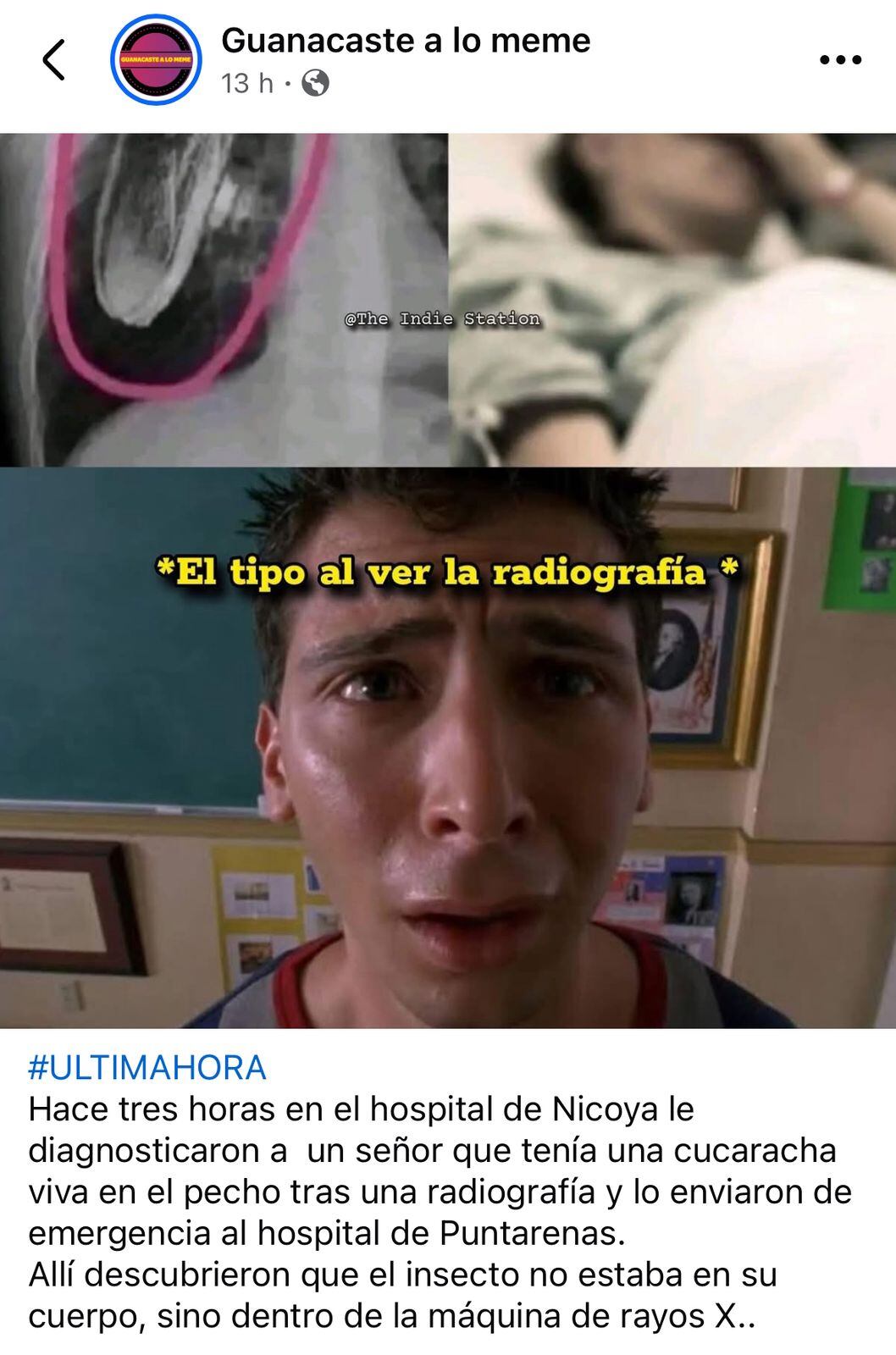 Cucaracha radiografía