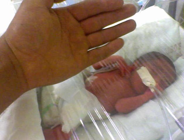 Bianka Cerdas Alvarado tiene 13 años. Nació a las 26 semanas de gestación. Vive en Tobosi, Cartago. Foto: Keyna Calderón