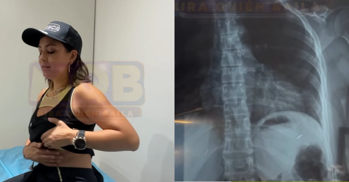 Thais Alfaro se golpeó la sexta costilla durante un ensayo con Kenneth González.