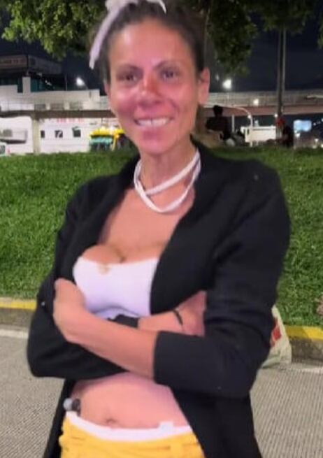 Fotos de Ingrid Karina Sánchez cuando fue encontrada como habitante de la calle.