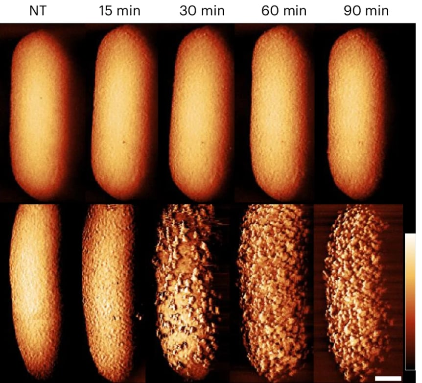 Imágenes revelan cómo la polimixina elimina bacterias y explican la resistencia en células latentes.