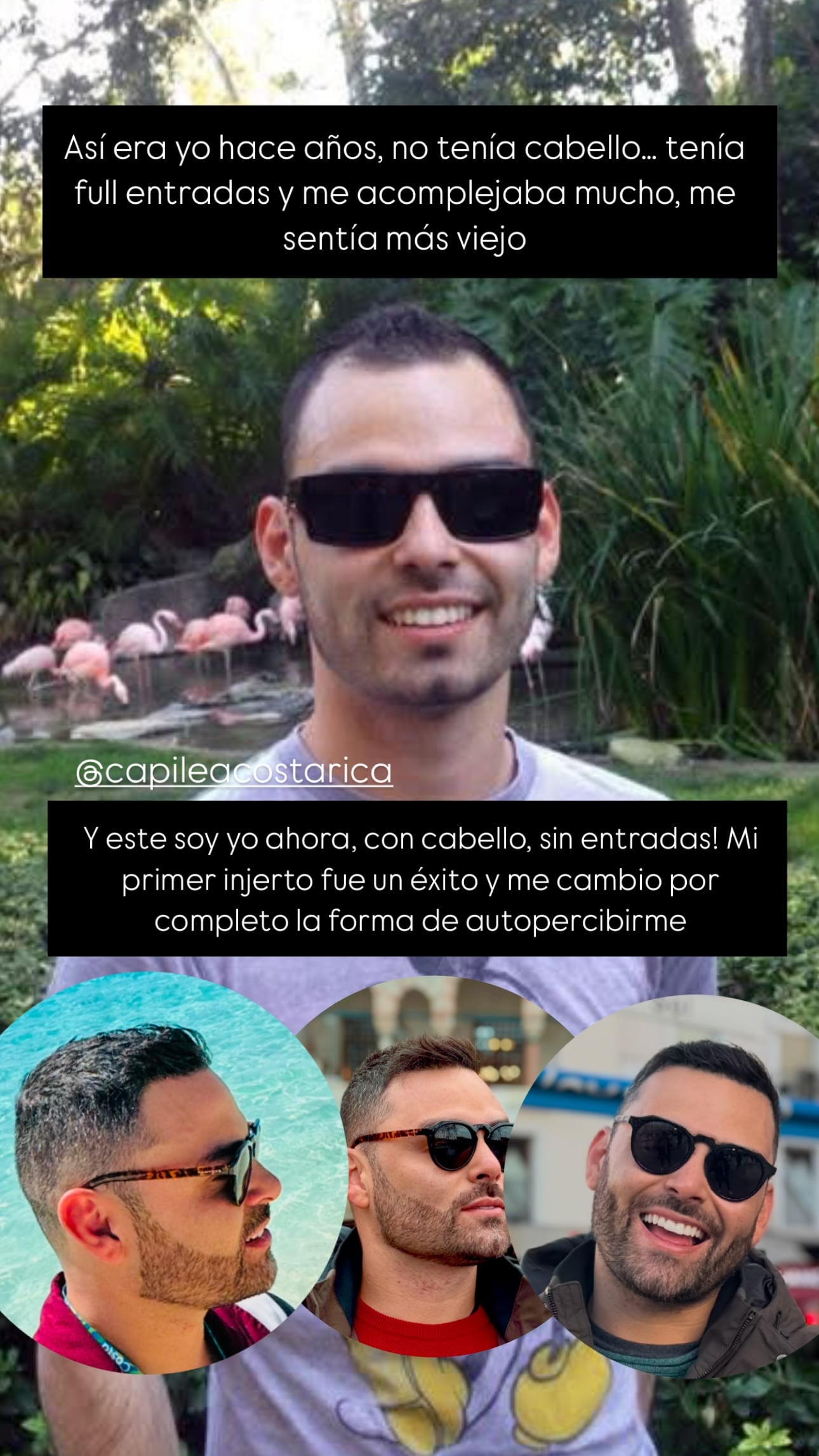 Diego Bravo se sometió este miércoles a un nuevo tratamiento estético que atacará de una vez por todas un complejo que ha tenido toda su vida.