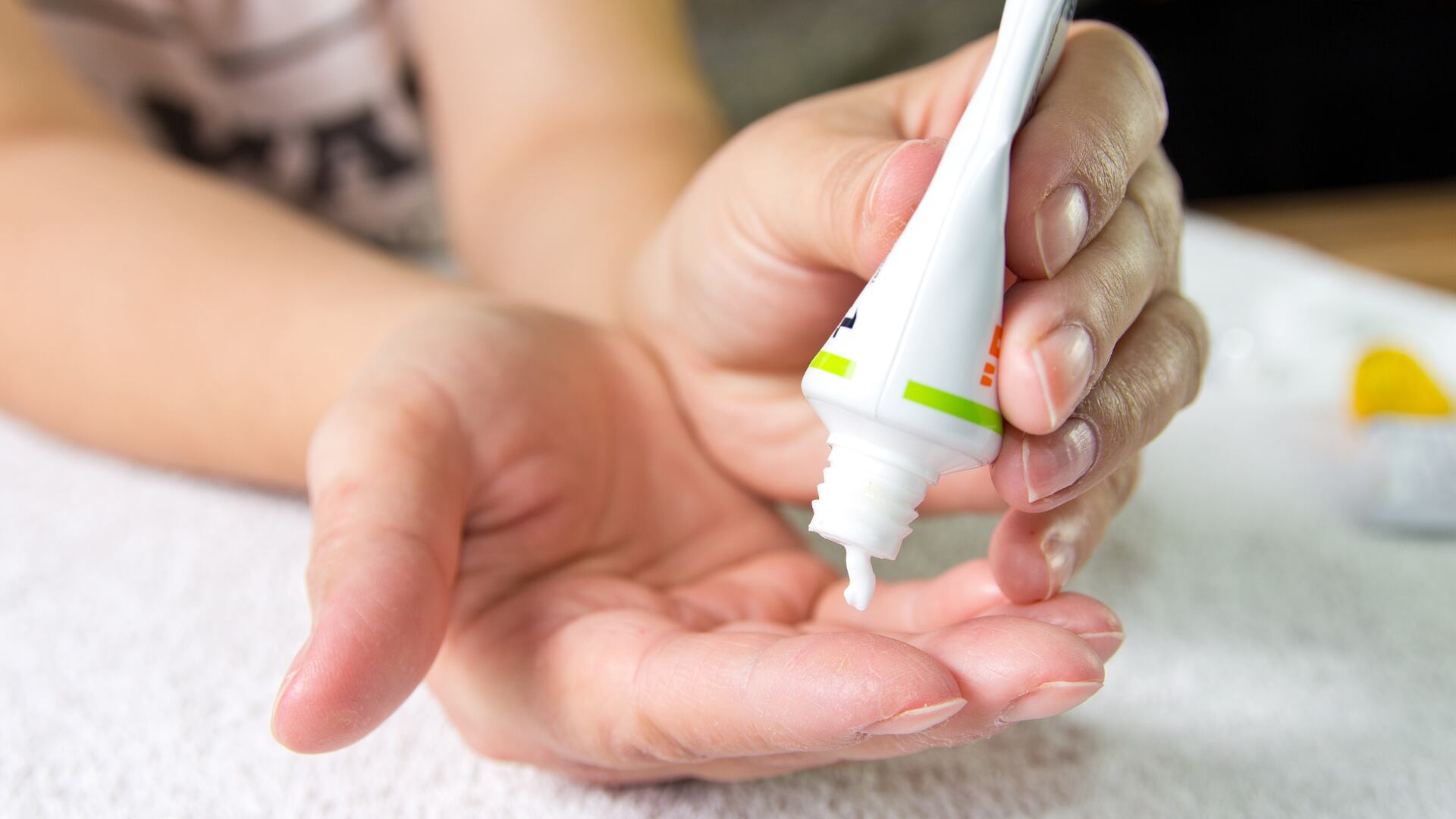 Descubra cómo la psoriasis puede controlarse con tratamiento, buenos hábitos y atención dermatológica constante.