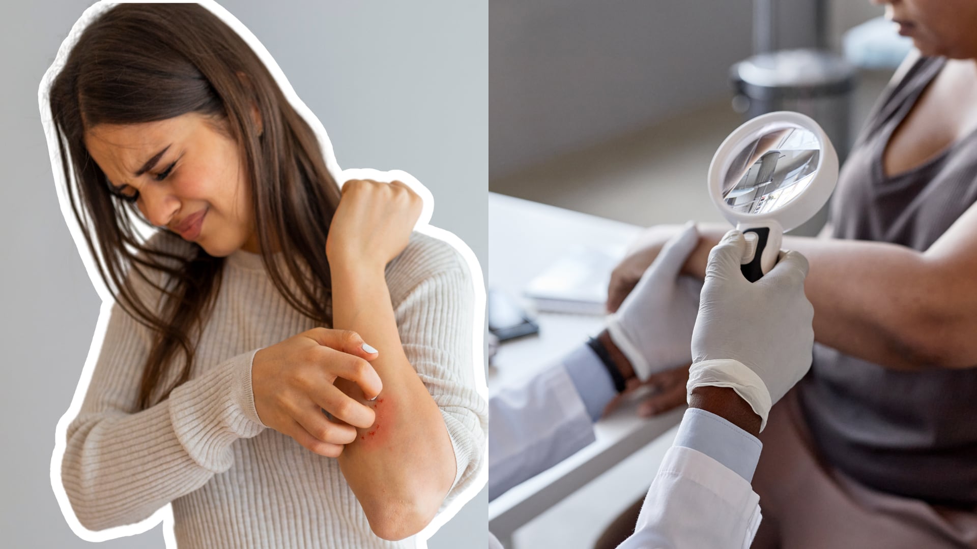 Más allá de las manchas o la picazón, esta enfermedad refleja cómo el cuerpo y la mente responden al estrés, los hábitos y el estilo de vida.