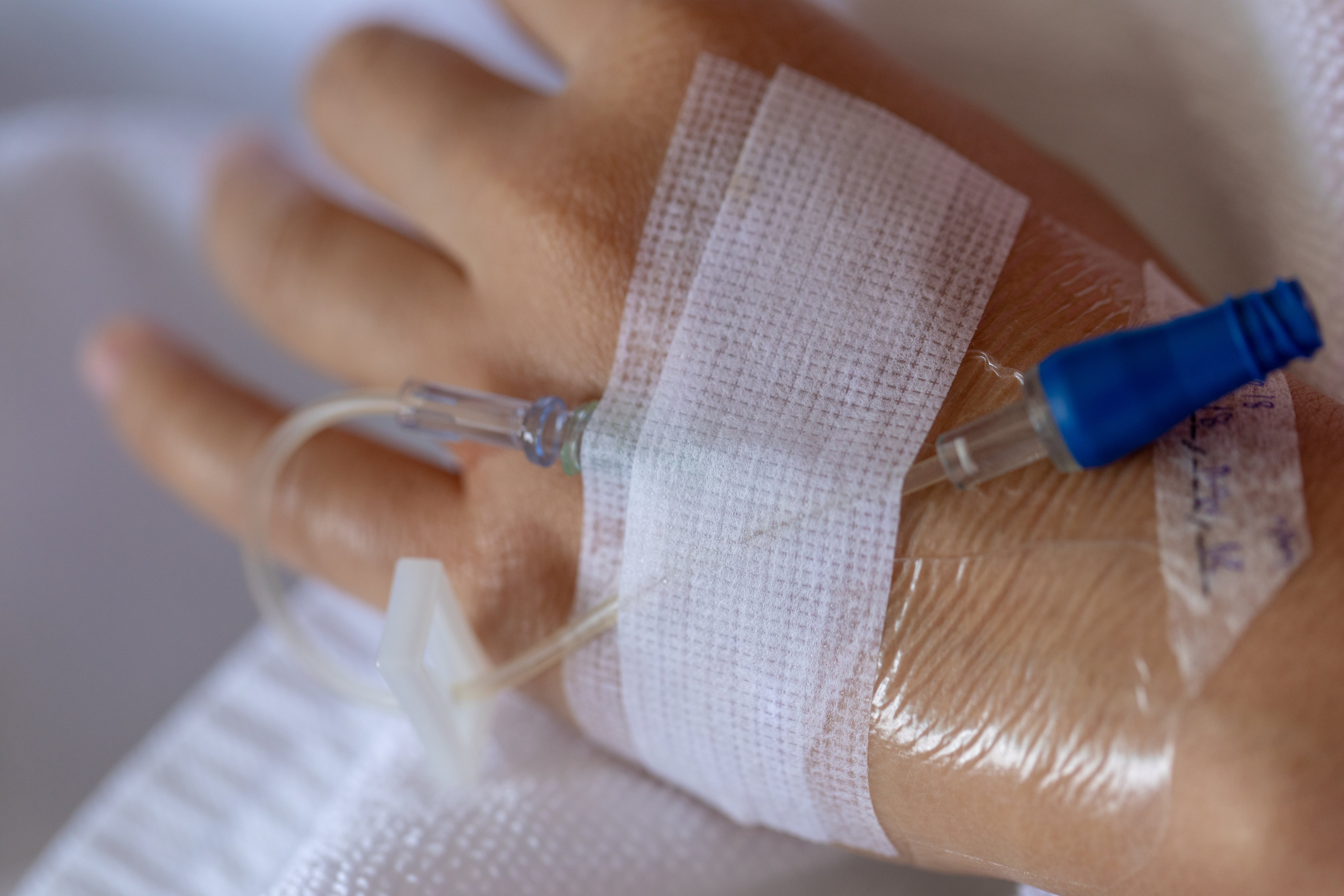 Primer plano de mano, brazo, con una vía endovenosa, recibiendo tratamiento a la vena