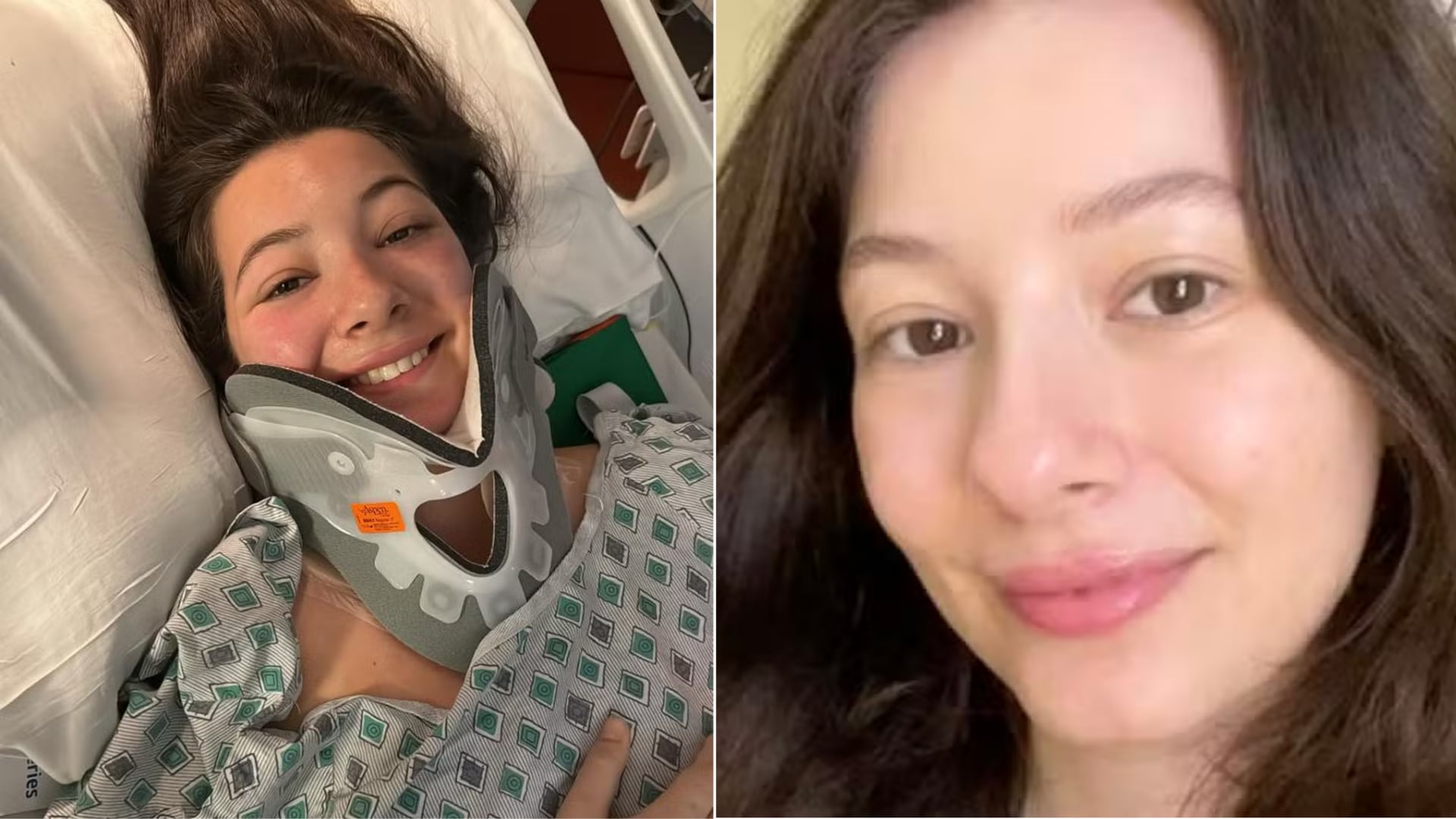 Maria Carolina Toledo, analista de mercadeo, muestra su evolución tras quedar parapléjica por una lesión medular en Nueva York. A sus 28 años, continúa su recuperación en Brasil con el apoyo de terapias físicas, psicológicas y el uso de andador y muletas.