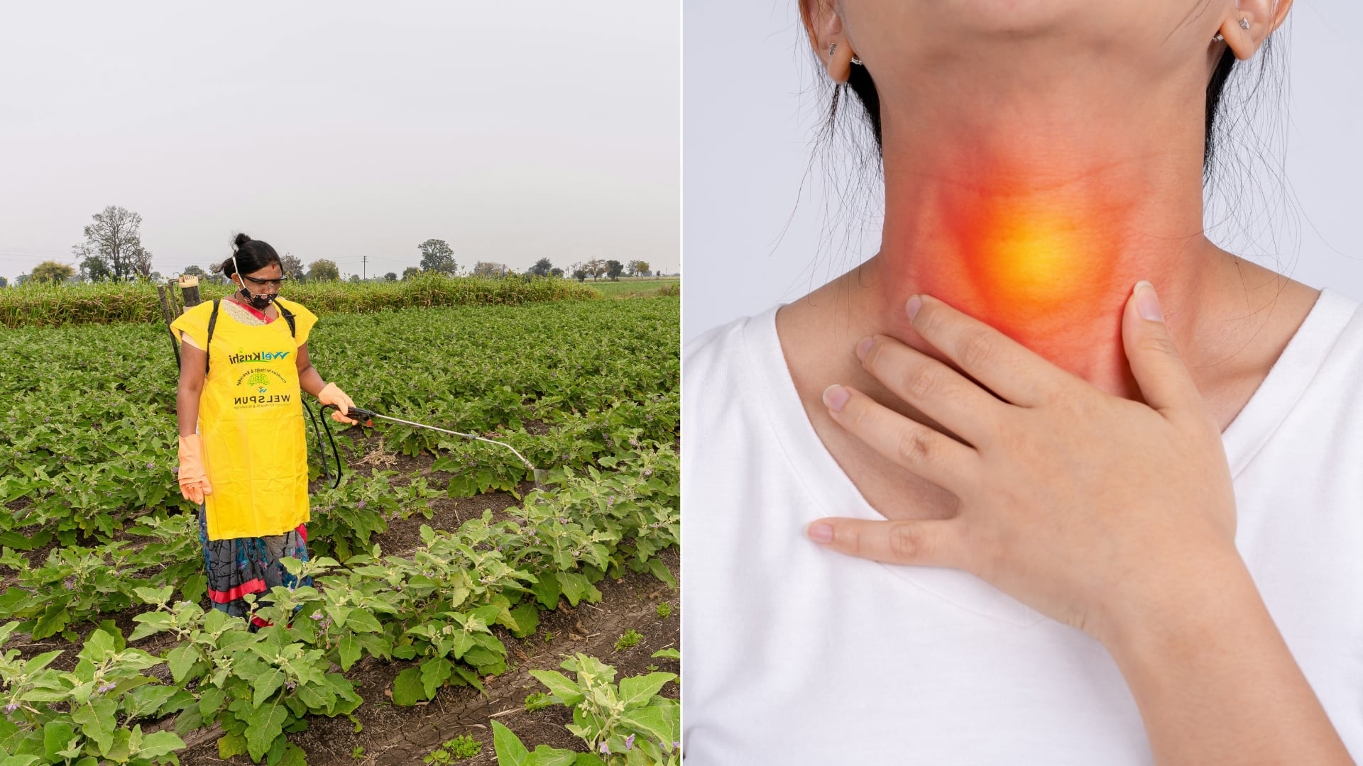 Una mujer denunció que el contacto con pesticidas durante sus estudios le provocó cáncer de tiroides.