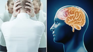 ¿Qué explica la psicopatía? Un estudio relaciona este trastorno con regiones más delgadas de la corteza cerebral