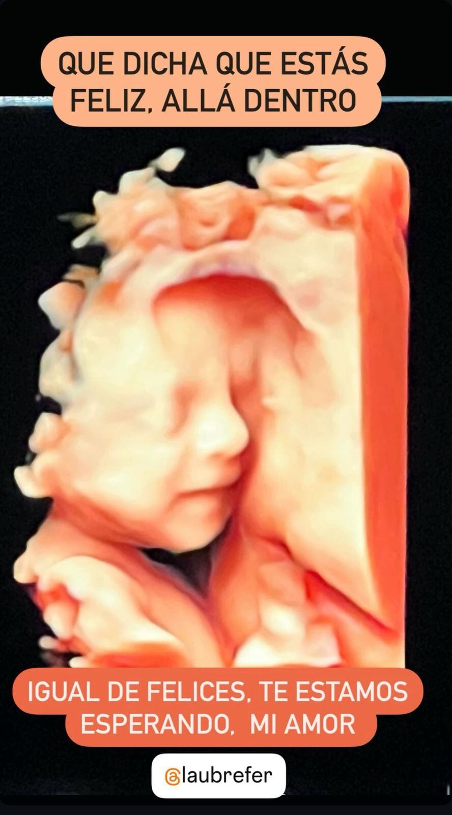 Hija de Jorge Martínez y Laura Brenes