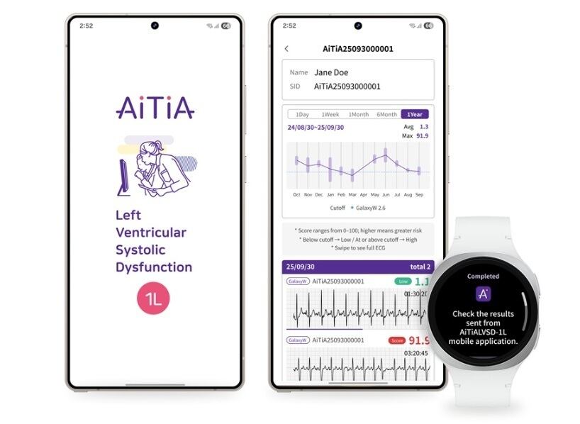 Aplicación de Samsung en un teléfono y un reloj inteligente muestra gráficos y resultados médicos relacionados con la detección de disfunción sistólica ventricular izquierda mediante un algoritmo de inteligencia artificial.