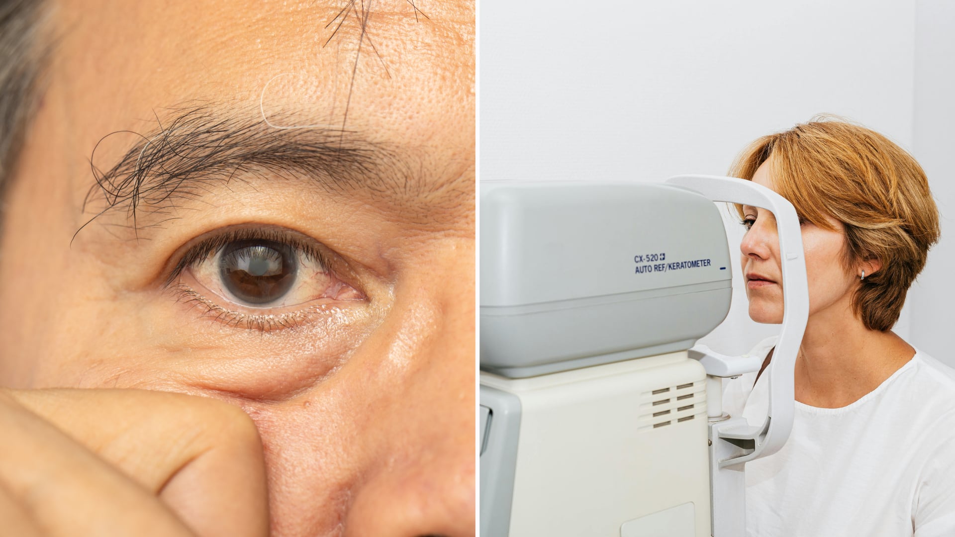 El glaucoma afecta entre 3% y 4% de la población argentina. Expertos impulsan exámenes gratuitos para promover el diagnóstico temprano.