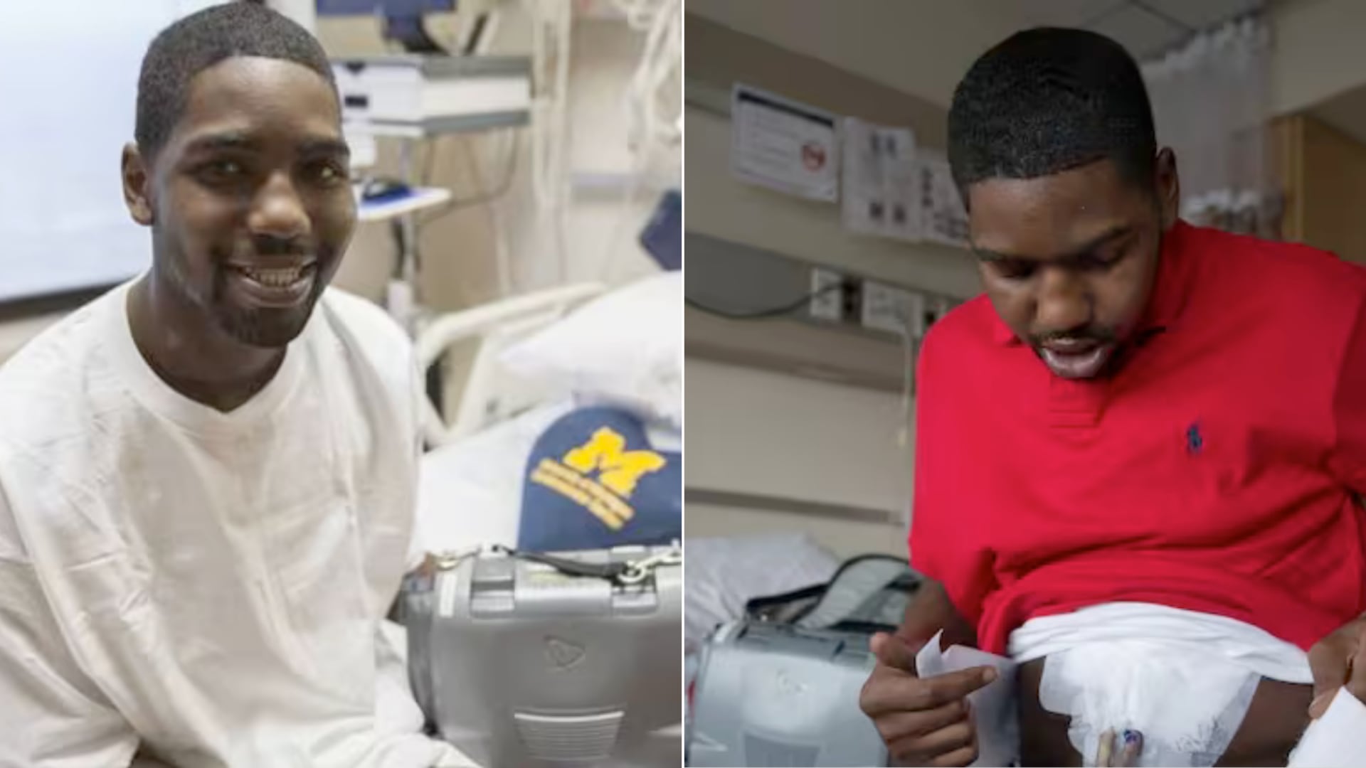 Con solo 16 años, un desmayo llevó a Stan Larkin a vivir 555 días con un corazón artificial antes de lograr un trasplante exitoso.