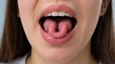 Qué significa que una persona pueda curvar la lengua o ponerla en ‘U’