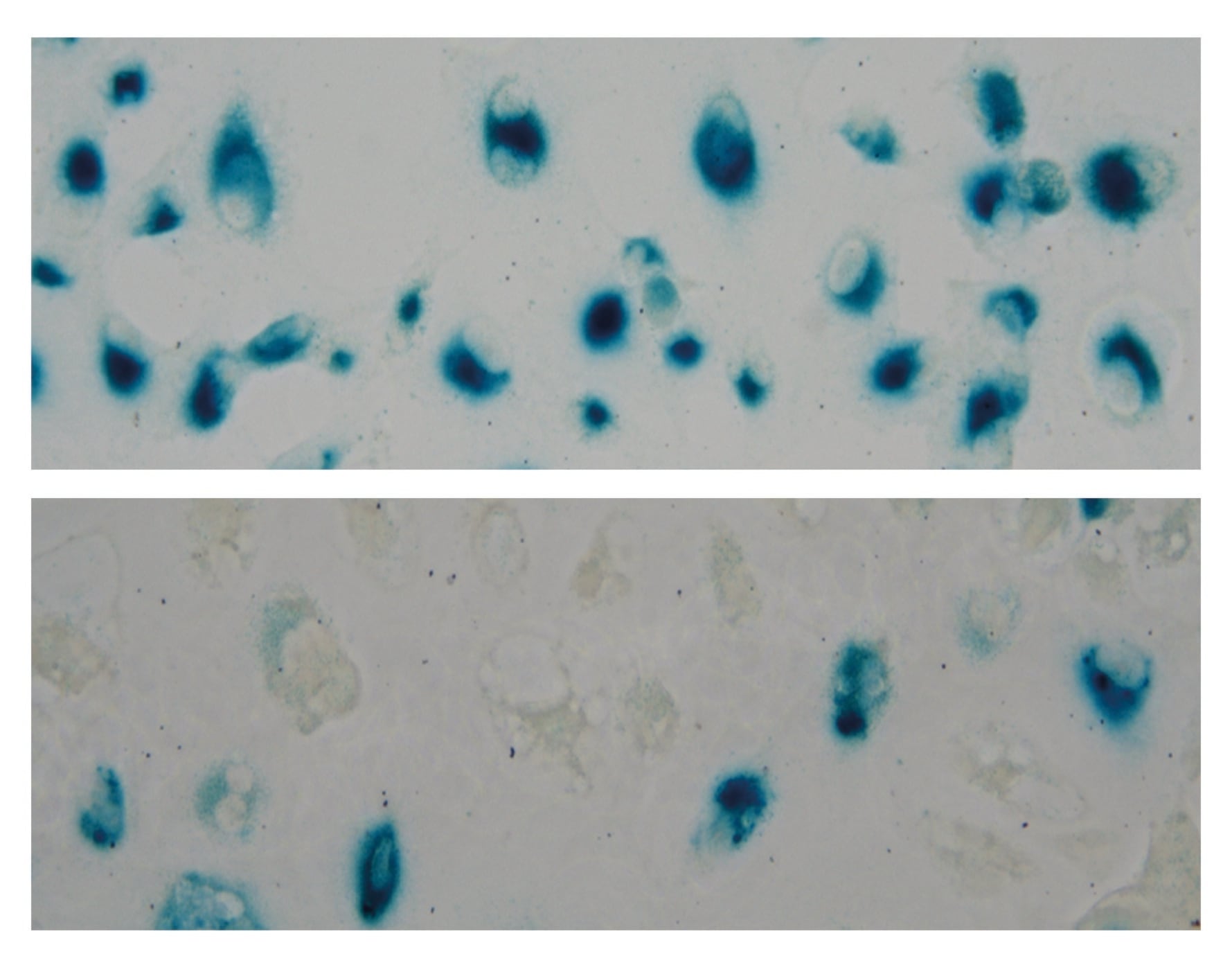 Imagen representativa de células con StnIG.
REMITIDA / HANDOUT por IMDEA NUTRICIÓN
Fotografía remitida a medios de comunicación exclusivamente para ilustrar la noticia a la que hace referencia la imagen, y citando la procedencia de la imagen en la firma
23/1/2026