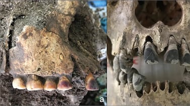 Cementerio de 2.000 años revela esqueletos con dientes negros y abre nuevas pistas científicas