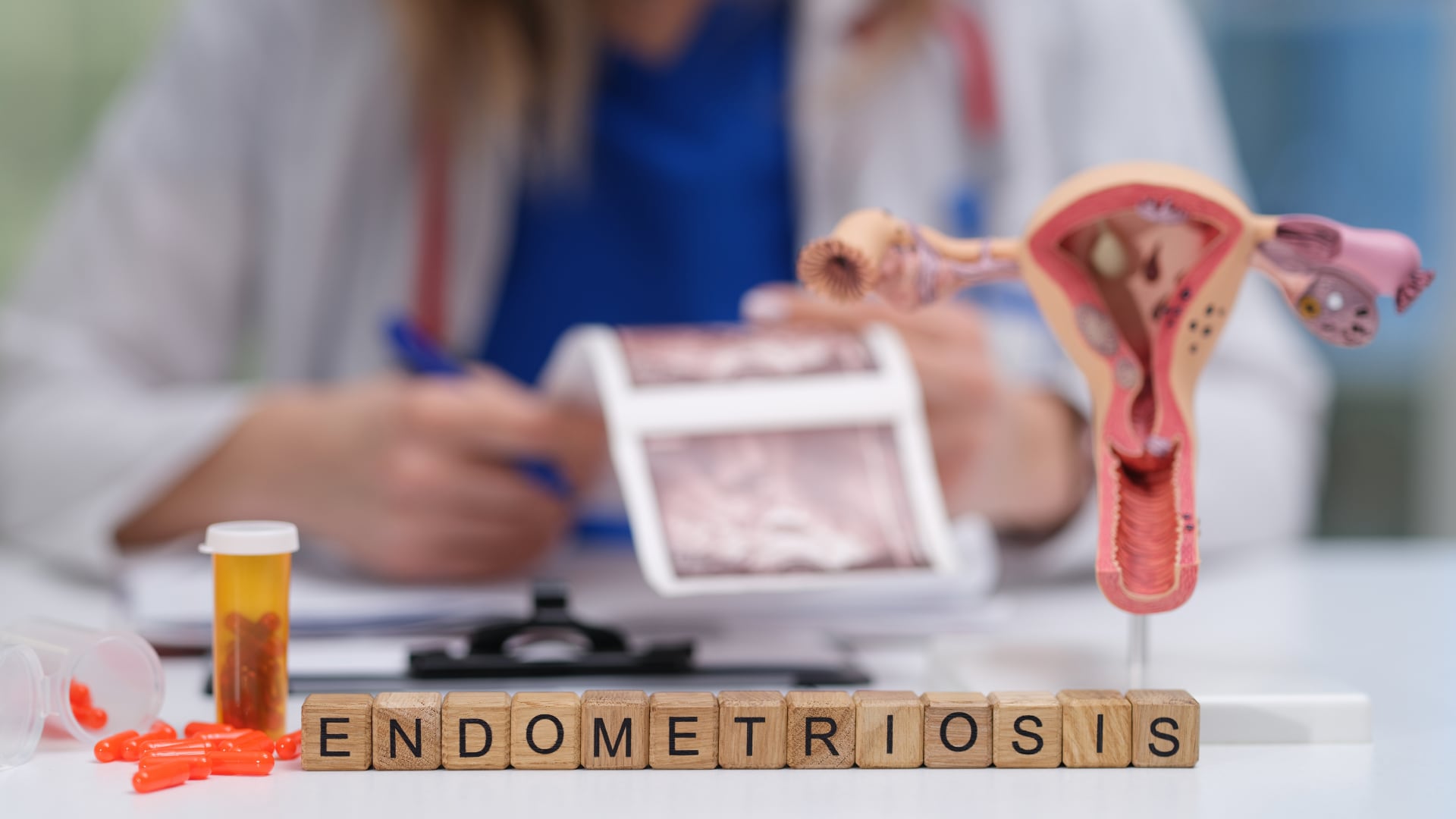 De acuerdo con la Organización Mundial de la Salud (OMS), la endometriosis es una enfermedad crónica y afecta a una de cada diez mujeres a nivel mundial.