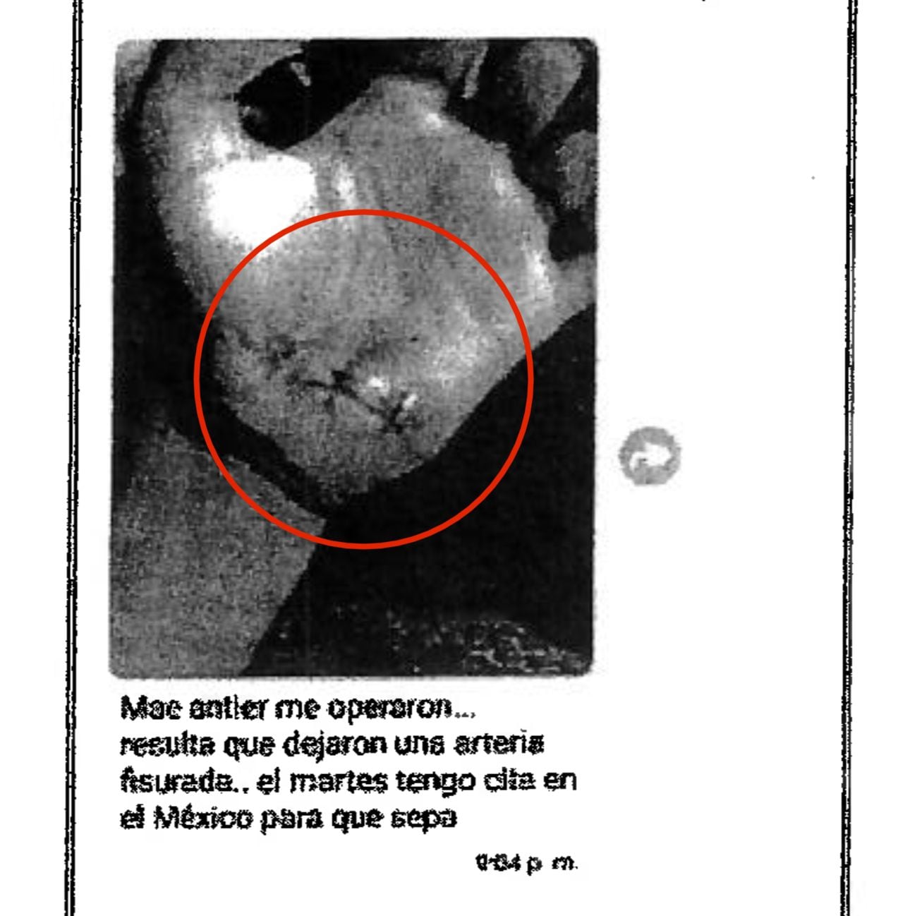 A varias personas Buzano les cambió la versión de la causa de la herida en su mano.