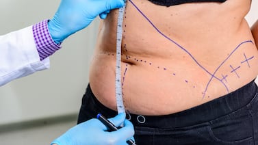 Cuando agradar cuesta la vida: la mortal dictadura de la belleza