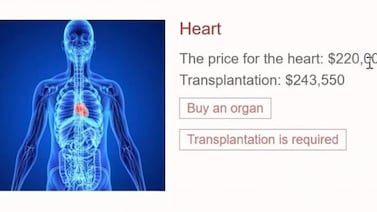 Comprar un corazón por $220.000 o hackear un Facebook por $250: así funcionan los mercados ilegales de la ‘dark web’