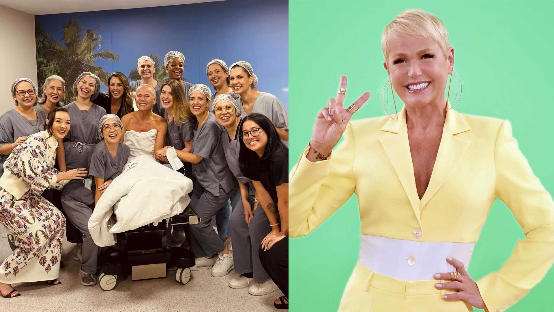 Xuxa se sometió a 80 procedimientos estéticos en São Paulo para estimular la producción de colágeno, utilizando la técnica Daycare que combina múltiples tratamientos en un solo día.