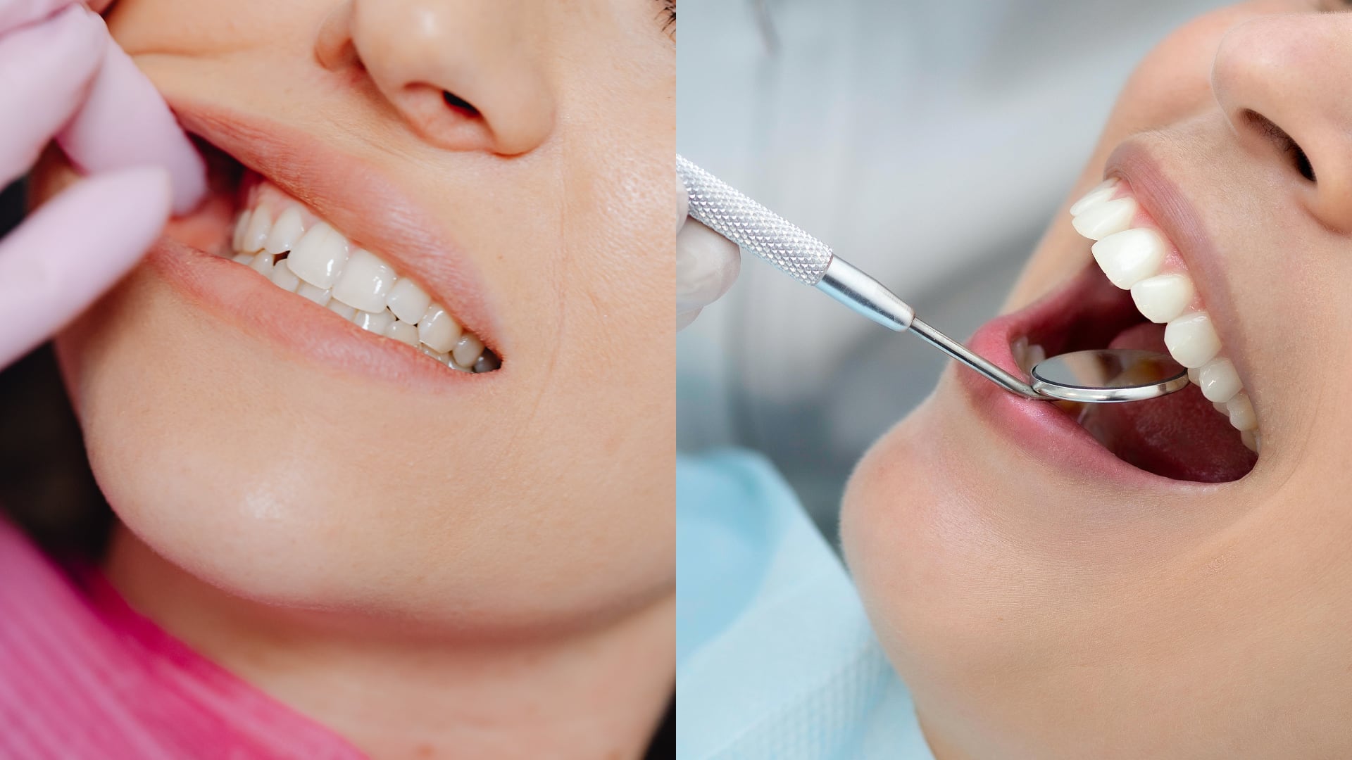 La EFP advierte que hay estudios que vinculan la periodontitis con infartos. La OMS estima que los padecimientos bucales afectan a 3.700 millones de personas.