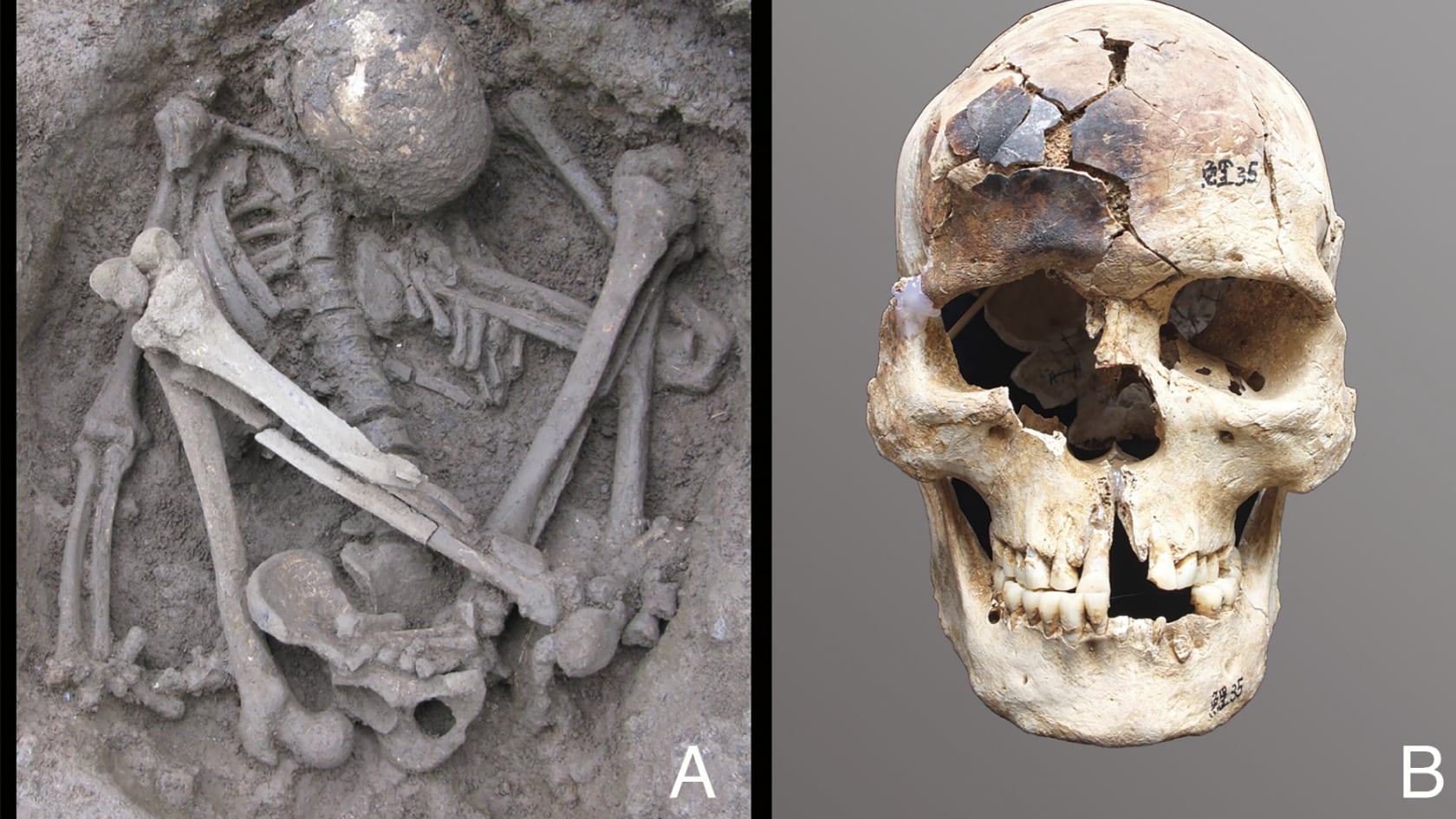 Un descubrimiento en Papúa Nueva Guinea desplazó a Egipto y Chile como cuna de la momificación más antigua registrada.