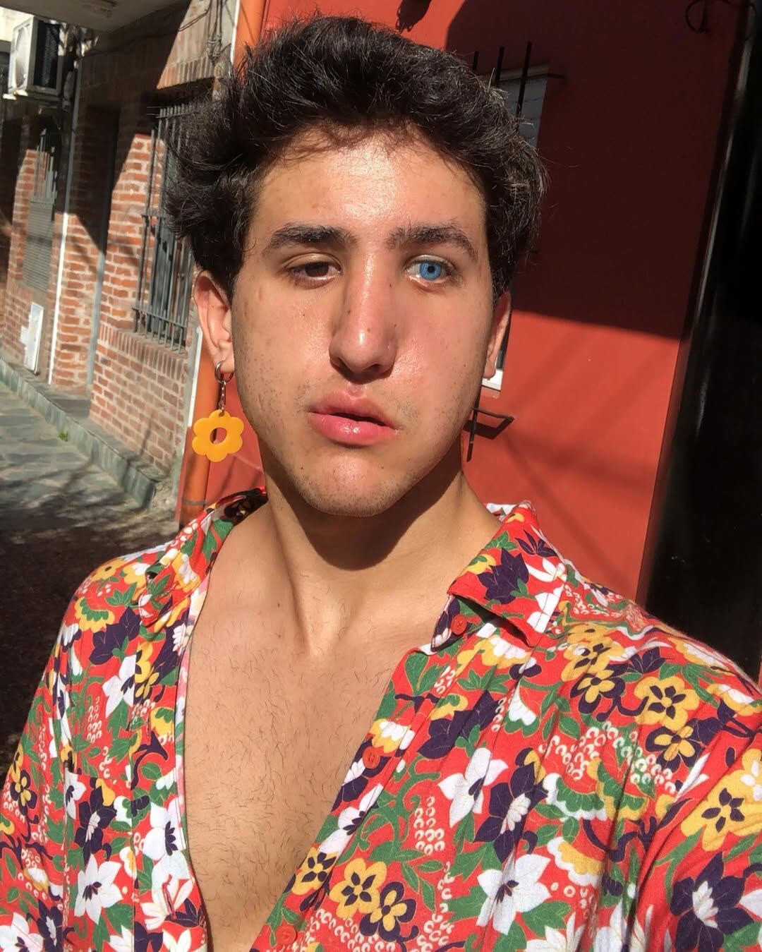 Joaquín Acebo sufrió un accidente a los cinco años en un parque de diversiones de Luján, Argentina.