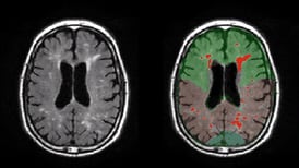  “Mapeo" de la actividad cerebral ayudaría a corregir patologías mentales 
