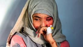 Al Anud, un rostro desfigurado por el ácido que representa la violencia machista en Yemen