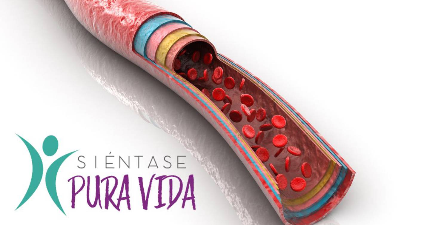 Años de los malos hábitos pueden llevar a formar placas en las arterias y esto dificulta el paso de la sangre.

Imagen: Shutterstock