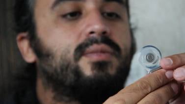 Tico Marcos Machado transmitió 'en vivo' su implante coclear para película 'SoundBoy'