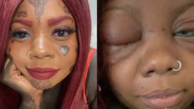Mujer de Irlanda se tatuó los ojos y ahora puede quedar ciega 